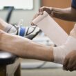 Ankle Discoloration