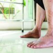 diabetic ulcer wound care